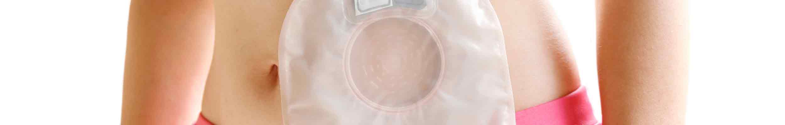 Ostomy and Urology Care
